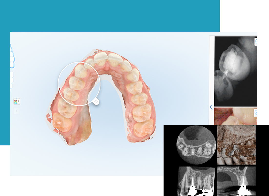 三次元撮影で精密診断
